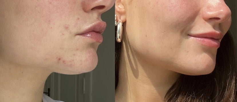 Hydrating and balancing Facial oil with Bakuchiol