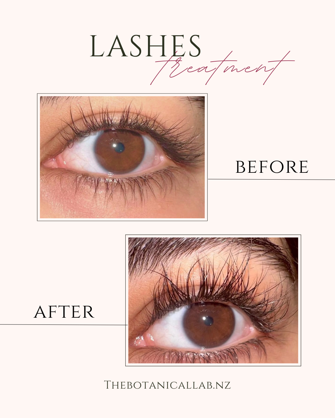Lashes & Brow Serum